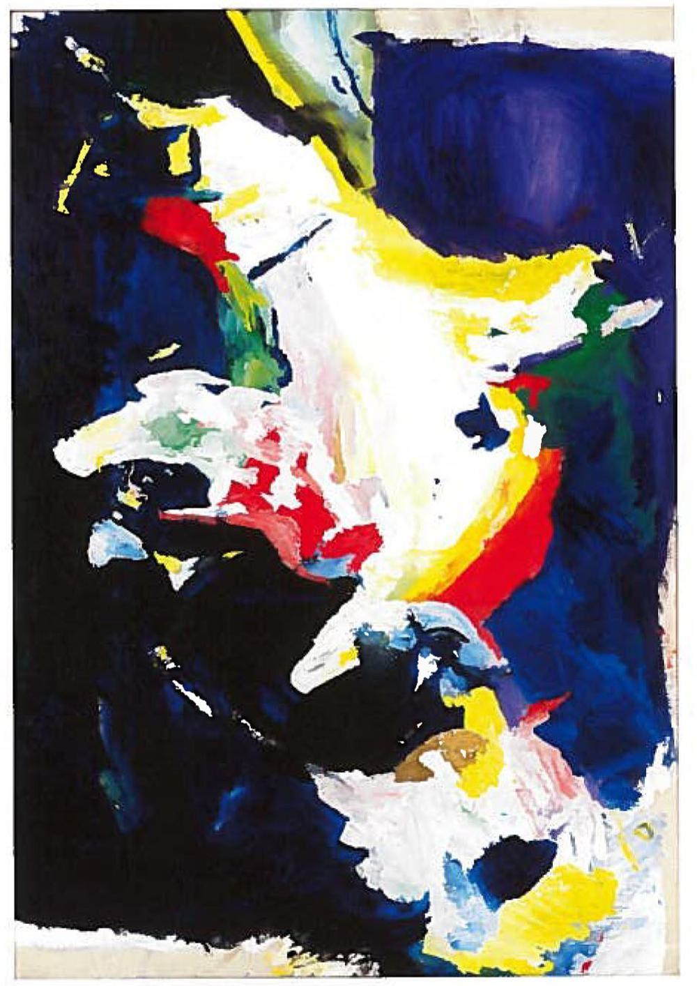Concussion